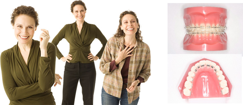 Adults Orthodontic Treatment